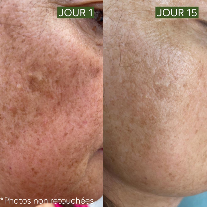 Light Up - Organic anti-dark spot serum